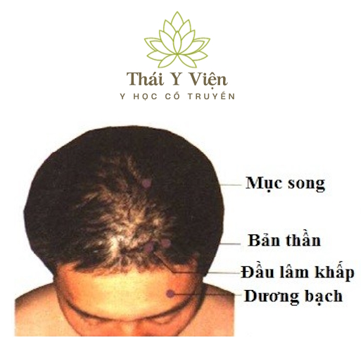 MỤC SONG