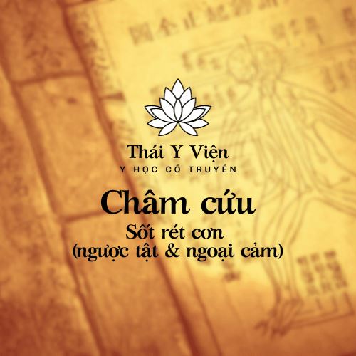 Sốt rét cơn (ngược tật & ngoại cảm)