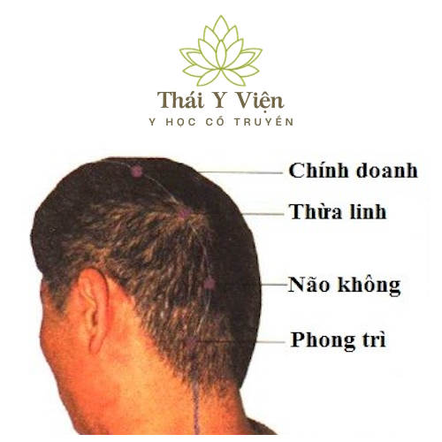 PHONG TRÌ